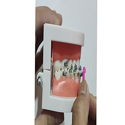 Плацери за еластични гумени ленти RZJZGZ за загради за еднократна употреба пластични ортодонтски еластични поставувачи со повеќе бои