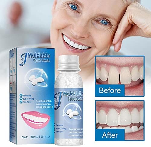 Cingk 10-30g заби и јаз фалцетет лепак смола за лепила лепила заби заби за заби на заби лапи за лепак привремена поправка на забите