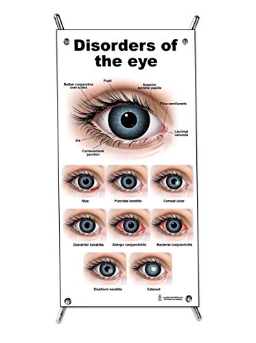 Око пакет со подароци од 5 парчиња за клиники за очи, здравствени саеми, офталмолог Оптометрист за очите доктор