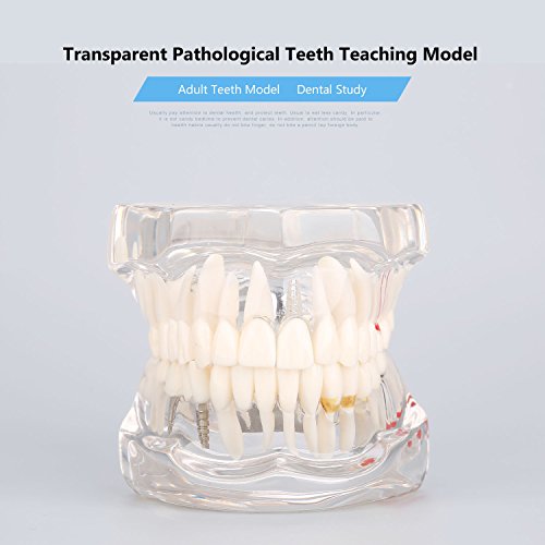 Модел на стоматолошко образование, модел за одвојување на забите, модел на стоматолошко образование, модел на стоматолошко заболување, наставна