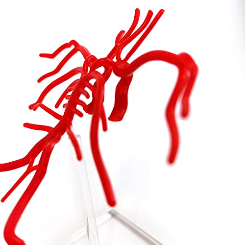 Модел на мозочна артерија Evotech, модел на интракранијална артерија на живот, покажува внатрешна каротидна артерија, Вилис Круг