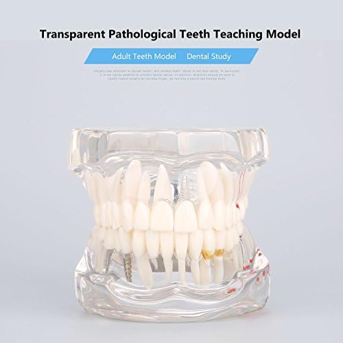 Отстранлив Стоматолошки Модел, Транспарентен Модел На Заб Стоматолог Патолошки Модел На Настава
