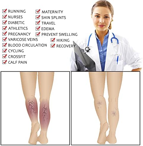 Здраво чорапи за компресија на Момоја за жени мажи колена високо водење на порибување 15-20 ммхг патувања атлетски