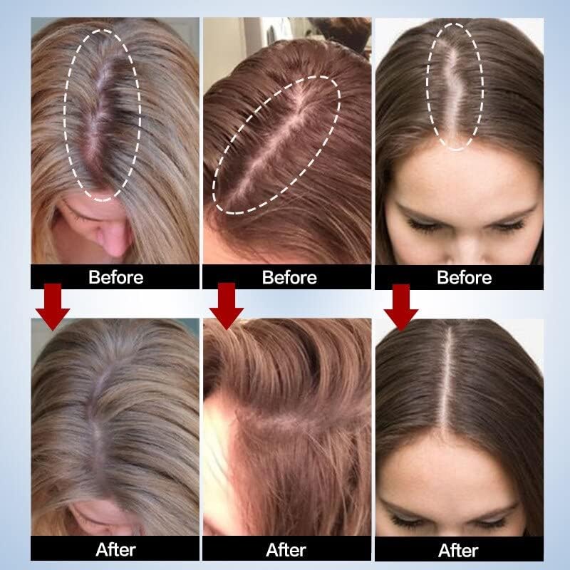 Ефективен Серум За Раст На Косата За Жени И Мажи Спречување На Губење На Косата Алопеција Течна Оштетена Поправка На Косата Расте