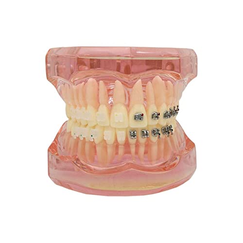 Денталмал стоматолошки ортодонтски заби модел на студии со метални загради за заграда M3003